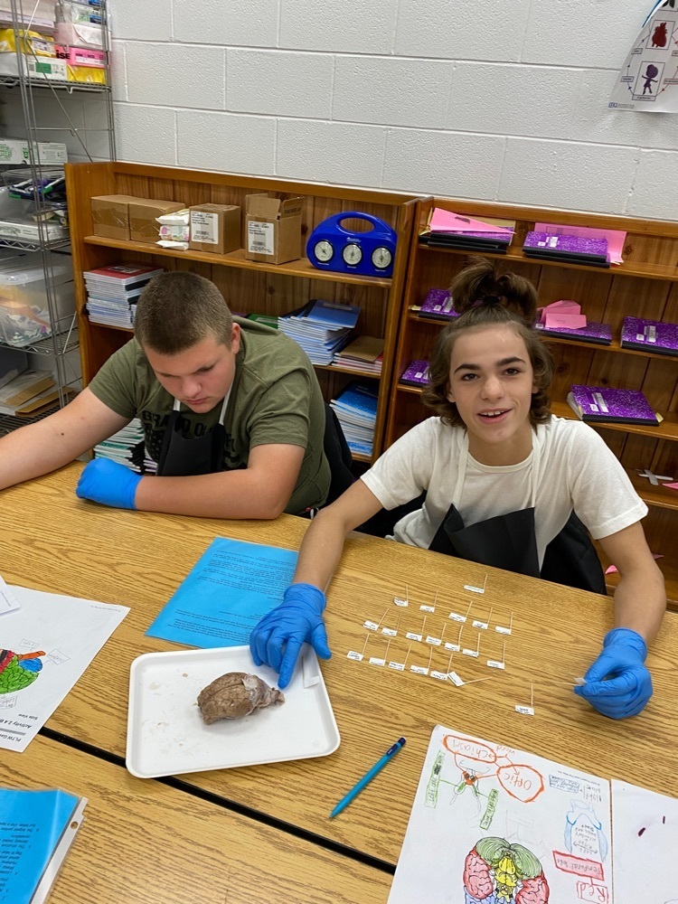 8th grade PLTW brain dissection and identification lab